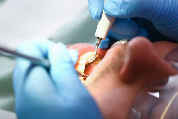 Best Emergency TMJ Treatment in Wolcott, IN